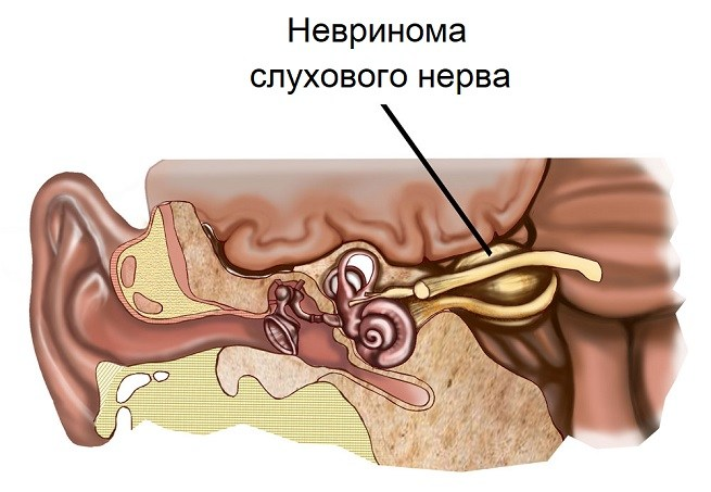 Болить голова и закладає вуха: основні причини, перша допомога, лікування